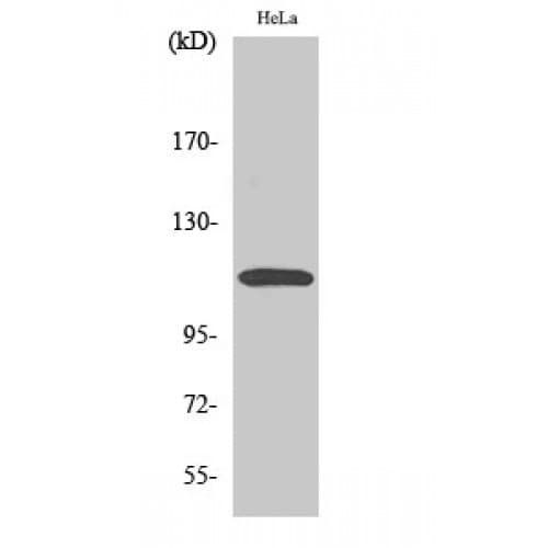 Polyclonal Rabbit anti-Human CARD10 / CARMA3 Antibody (450-530 aa, Internal, IHC, IF, WB)