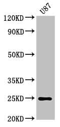RGS2 Antibody (aa1-211)