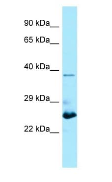 MOB1B / MOBKL1A Antibody (C-Terminus)