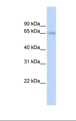 SLC22A6 / OAT1 Antibody (C-Terminus)