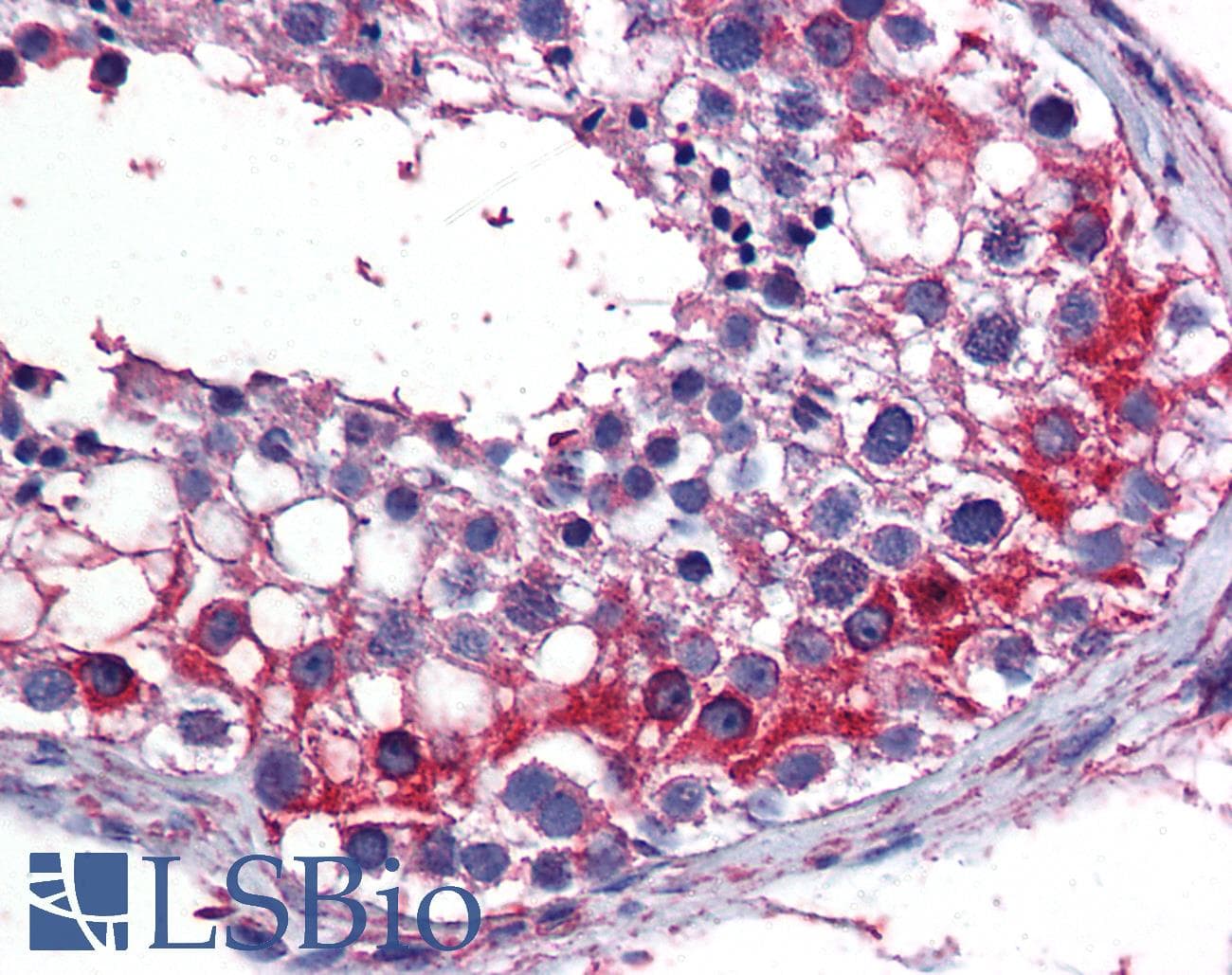 IHC-plus™ TES / Testin Antibody (clone 1G11-B7)