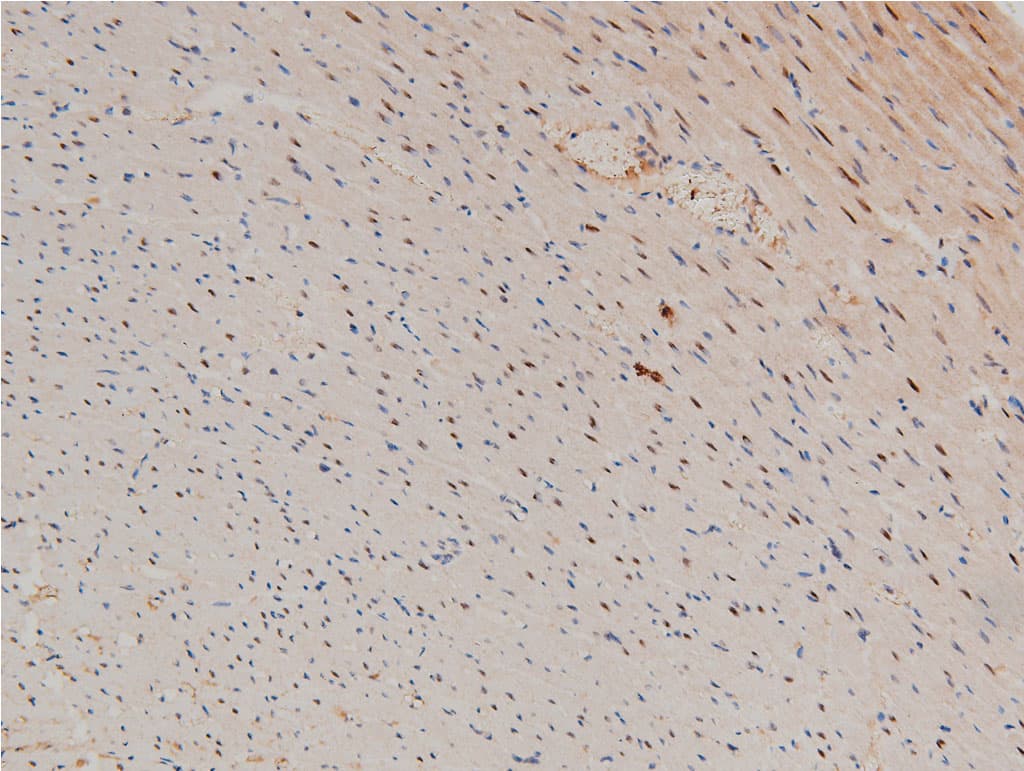 LIMK1 / LIMK Antibody (phospho-Thr508)