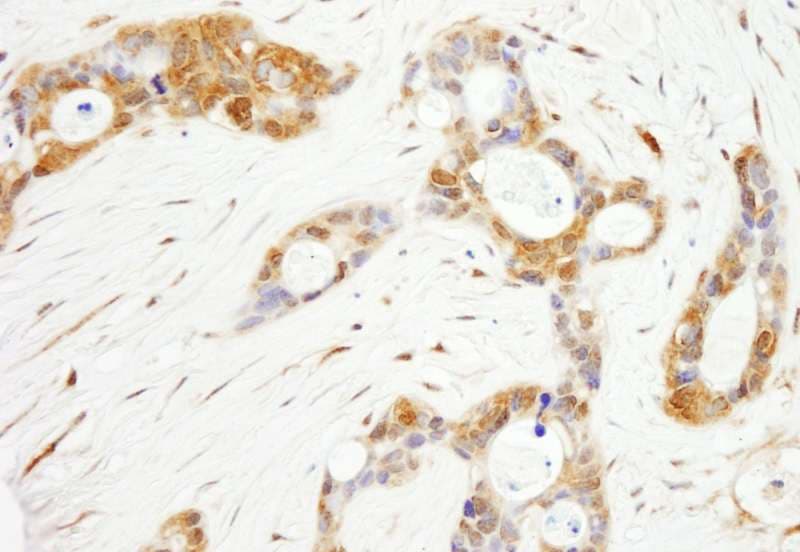 OXSR1 / OSR1 Antibody (aa325-375)