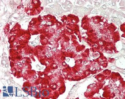 IHC-plus™ Polyclonal Goat anti-Mouse GLP1R / GLP-1 Receptor Antibody (aa129-140, IHC, WB)