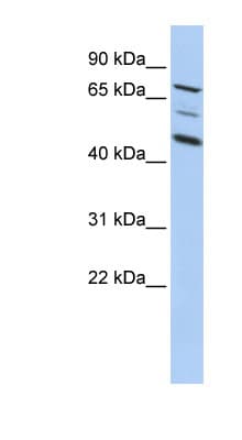 AKAP8 / AKAP95 Antibody (aa395-444)