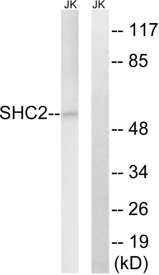 SHC2 / SLI Antibody (aa261-310)