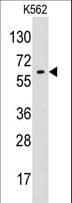 IHC-plus™ GPC6 / Glypican 6 Antibody (aa16-46)