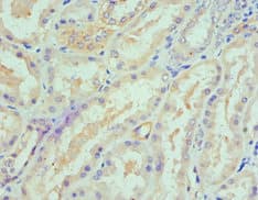 Polyclonal Rabbit anti-Human SPTLC1 / HSN1 Antibody (aa37-310, IHC, WB)