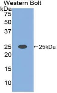 CLEC4C / CD303 / BDCA-2 Antibody (aa5-183)