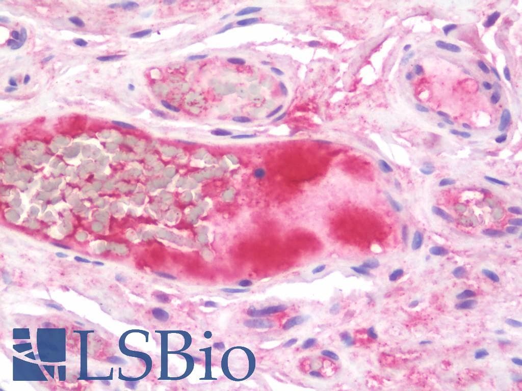 IHC-plus™ KNG1 / Kininogen / Bradykinin Antibody (aa138-166)