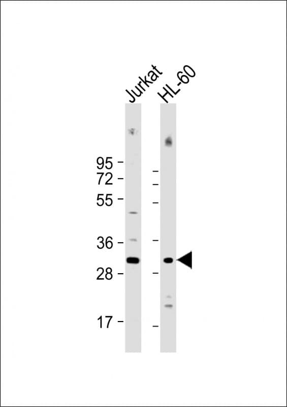 Polyclonal Rabbit anti-Human COPS7B / CSN7B Antibody (Internal, WB)