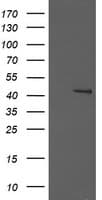 MAP2K1 / MKK1 / MEK1 Antibody (clone OTI1F4)