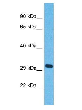 Polyclonal Rabbit anti-Human OR5J2 Antibody (aa257-306, WB)