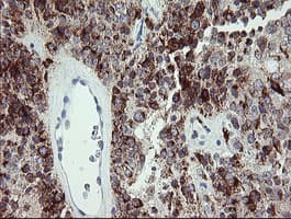 CDKN2B / p15 INK4b Antibody (clone OTI2D11)