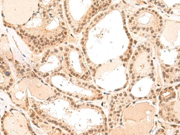 MKX Antibody