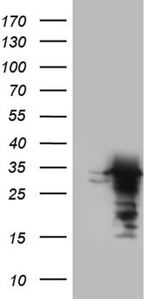 Monoclonal Mouse anti-Human UFD1L Antibody (clone OTI3B4, WB)