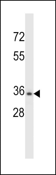 CELA3B / ELA3B Antibody (aa70-98)