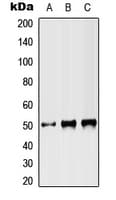 Polyclonal Rabbit anti-Human ST3GAL3 / ST3N Antibody (Internal, WB)