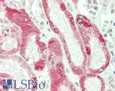 IHC-plus™ M6PR Antibody