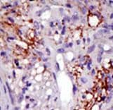 Polyclonal Rabbit anti-Human USP22 Antibody (aa351-380, IHC, WB)