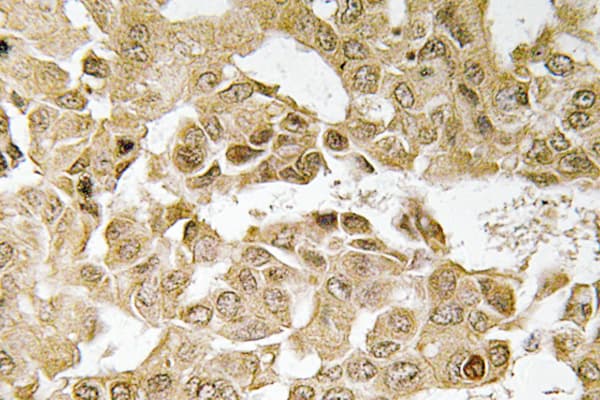 Polyclonal Rabbit anti-Human MAP2K1 / MKK1 / MEK1 Antibody (Thr286, IHC, WB)