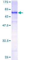 Human TLE6 Protein (Recombinant GST)