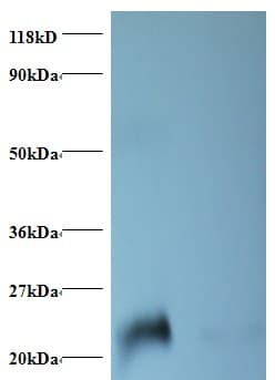 LCN2 / Lipocalin 2 / NGAL Antibody (FITC)