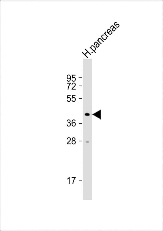 NPTX2 Antibody (aa 160-189, Internal)