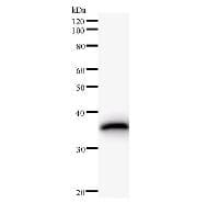 NAB1 Antibody (clone 2607C2a)