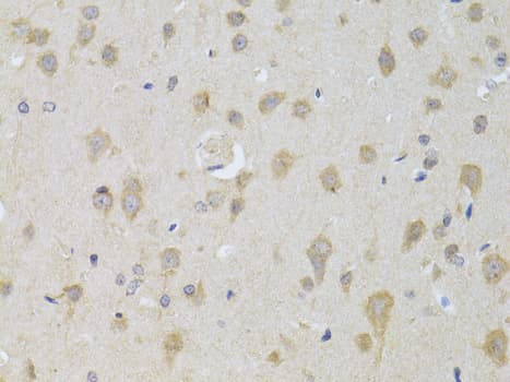 KIAA0652 / ATG13 Antibody