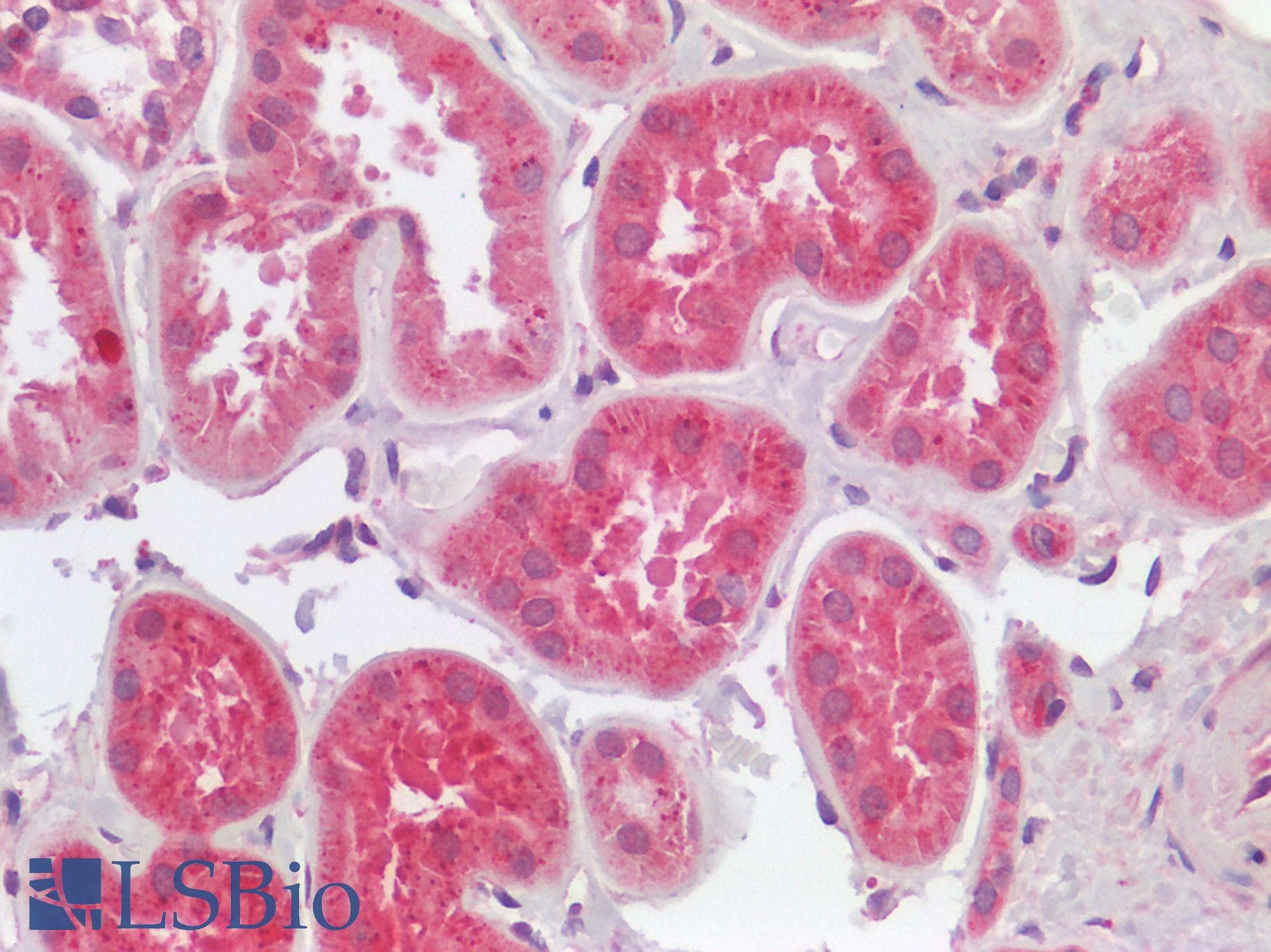 IHC-plus™ Polyclonal Rabbit anti-Human CTSL / Cathepsin L Antibody (IHC)