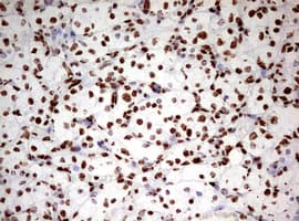 Monoclonal Mouse anti-Human HNRPM / HNRNPM Antibody (clone OTI3F3, aa1-261, IHC, WB)