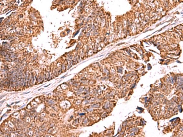 UBAC1 / KPC2 Antibody