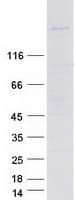 Human MYPN Protein (Recombinant Myc-DDK (Flag))
