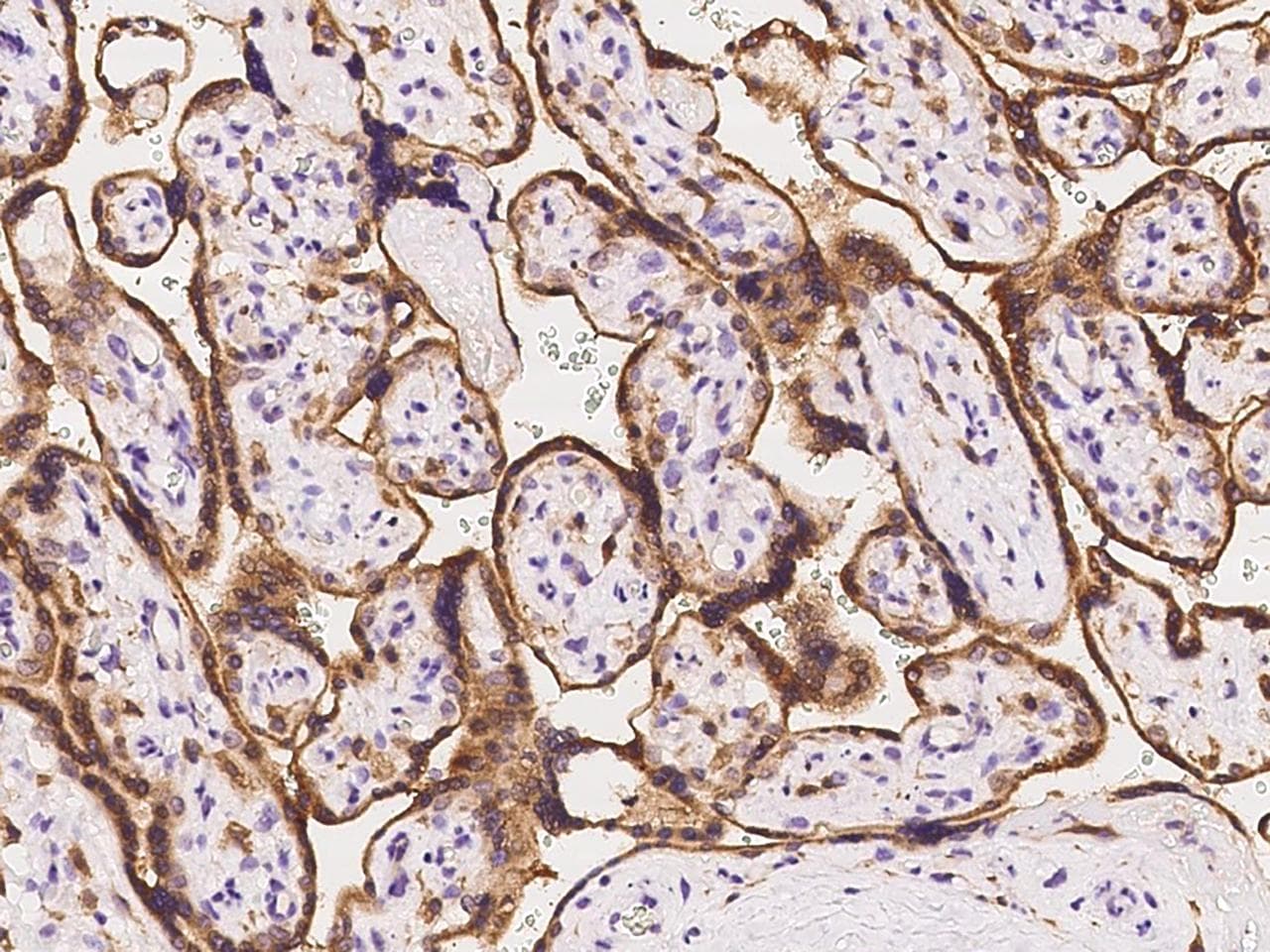 Polyclonal Rabbit anti-Human TIP30 / HTATIP2 Antibody (IHC, WB)