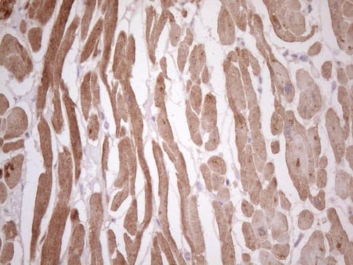 TCAP / Telethonin Antibody (clone OTI11H10)
