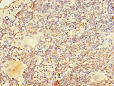 PAX3 Antibody