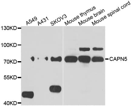 Polyclonal Rabbit anti-Human CAPN5 / Calpain 5 Antibody (AP, IHC, IF, WB)