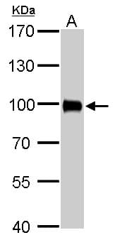 IHC-plus™ VIL1 / Villin Antibody (aa7-246)