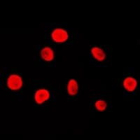 Polyclonal Rabbit anti-Human MSH2 Antibody (Internal, IHC, IF, WB)