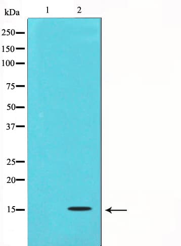 TGFB3 / TGF Beta3 Antibody