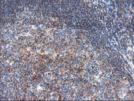 TFG Antibody (clone OTI2C3)