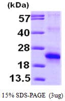 Human EIF5A2 Protein (Recombinant His)