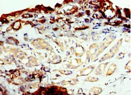 Polyclonal Rabbit anti-Human FUT6 Antibody (aa170-359, IHC, WB)