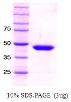 Human SETD7 / SET7 Protein (Recombinant)
