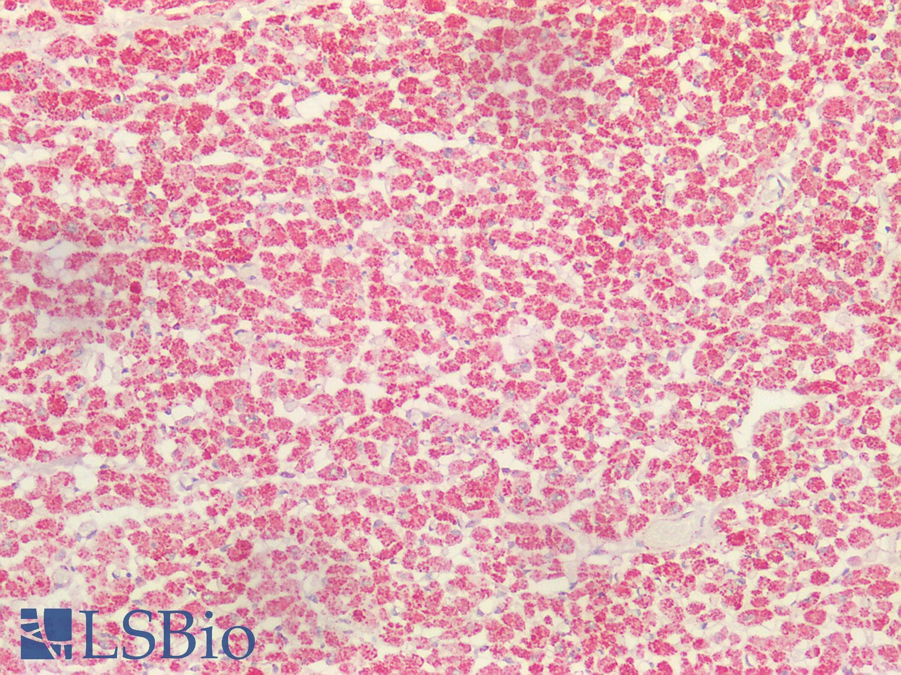 Polyclonal Rabbit anti-Human S100 Protein Antibody (IHC, IF, WB)
