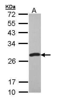 IHC-plus™ Polyclonal Rabbit anti-Human PCMT1 Antibody (aa10-227, IHC, WB)