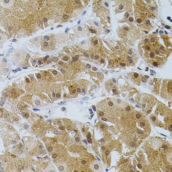TGM2 / Transglutaminase 2 Antibody