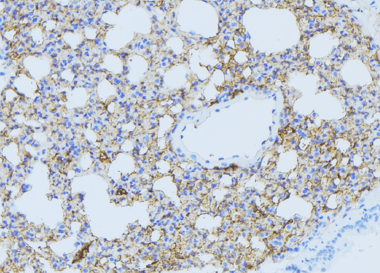 Polyclonal Rabbit anti-Human DHODH Antibody (IHC, IF, WB)