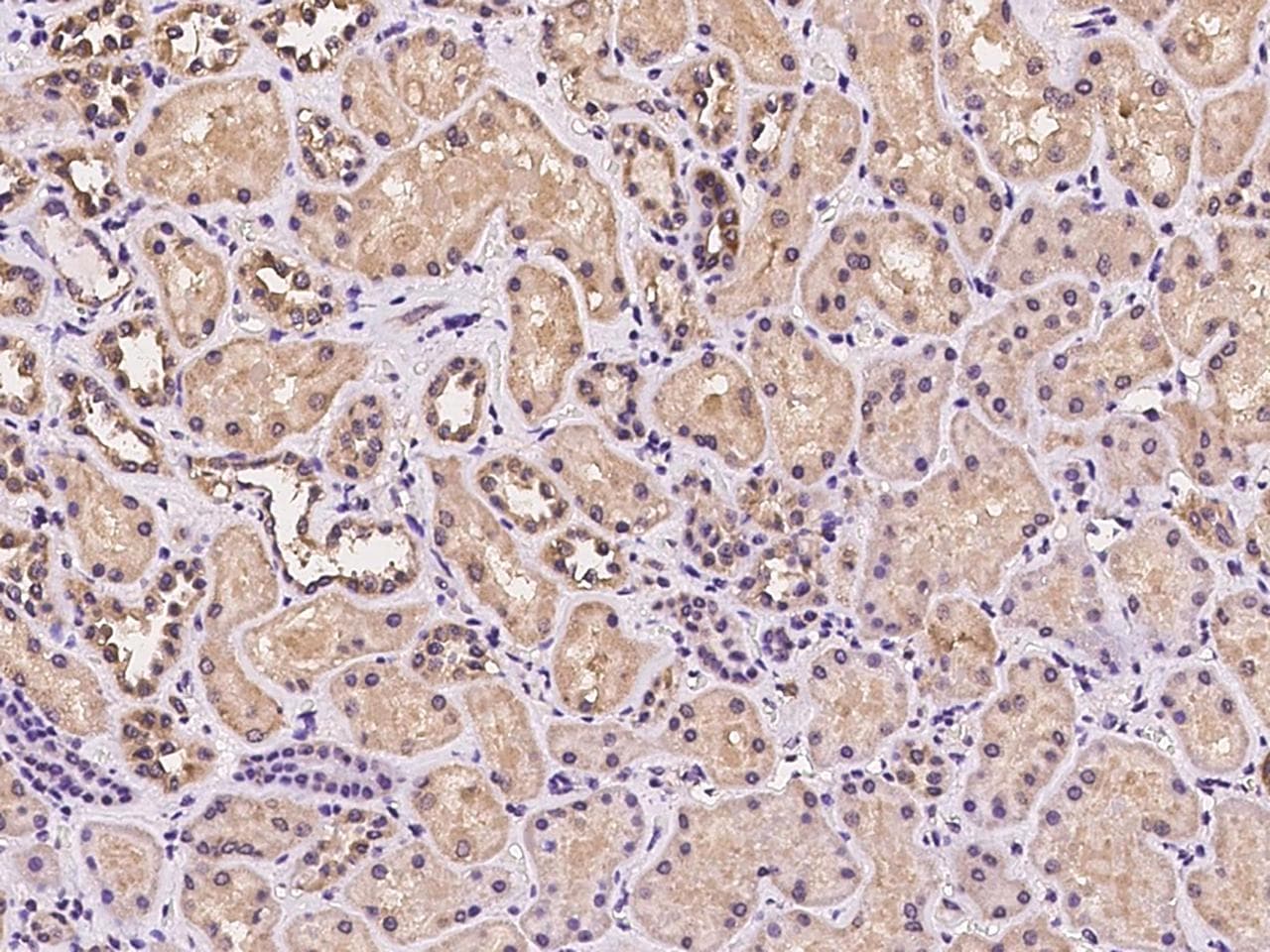 MRPL45 Antibody